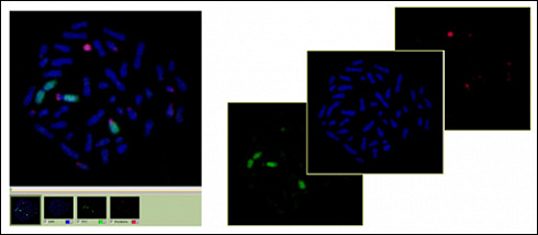 Программное обеспечение для FISH анализа и диагностики